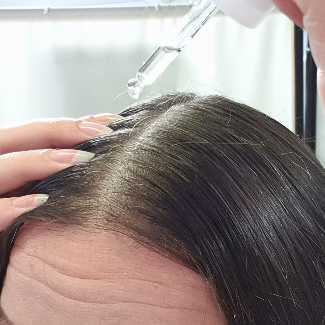 Root Activating Scalp Serum